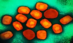 África en alerta por virus mpox: se transmite por vía sexual y amenaza con extenderse