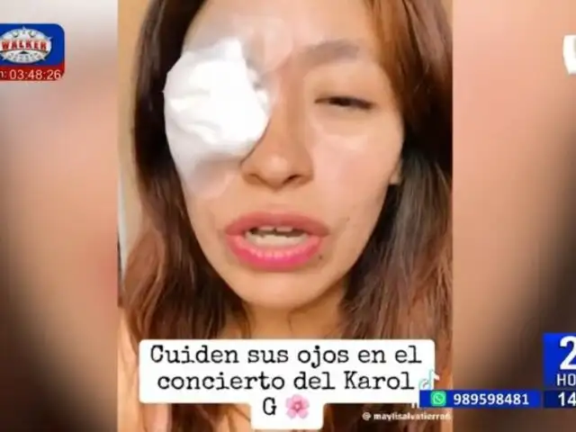 Karol G en Lima: Mujer termina herida del ojo por pirotécnico durante concierto de la "Bichota"
