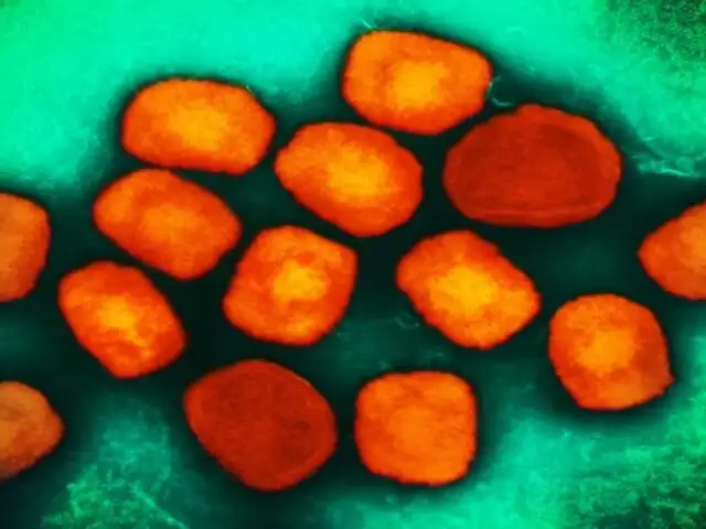África en alerta por virus mpox: se transmite por vía sexual y amenaza con extenderse