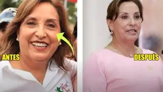 Cirujano asegura que presidenta Boluarte tiene sus arreglos: “Es muy evidente”