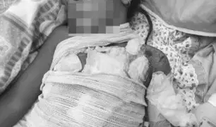 Tragedia en Arequipa: menor de edad fallece tras incendio causado por la explosión de un celular