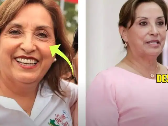 Cirujano plástico asegura que presidente Boluarte tiene sus arreglos: “Es muy evidente”
