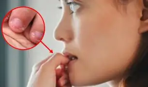 Estas son las consecuencias de morderse las uñas: Un hábito con riesgos ocultos