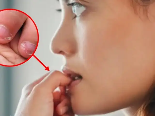 Estas son las consecuencias de morderse las uñas: Un hábito con riesgos ocultos
