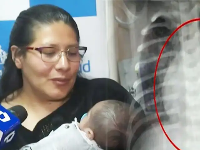 ¡Exitosa operación le devuelve la vida!: Médicos reconstruyen corazón de bebé huancaíno de 3 meses