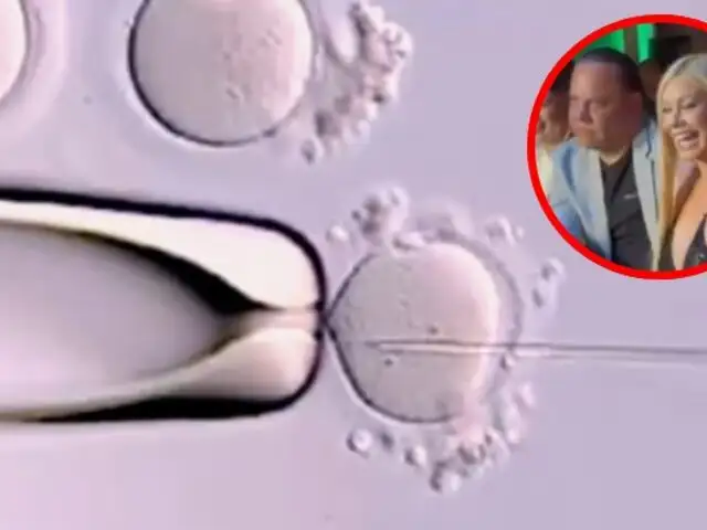 Fecundación in vitro: ¿En qué consiste la técnica reproductiva elegida por Daylin Curbelo y Mauricio Diez Canseco?