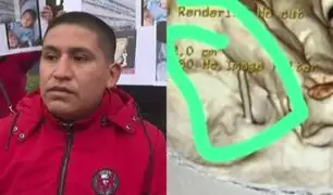 Padres denuncian que su niño fue a consulta dental y terminó con aguja en el cerebro