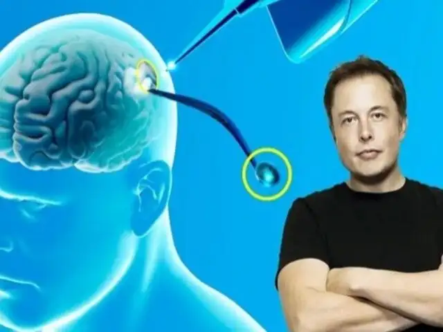 Elon Musk aboga por chips cerebrales para equilibrar el poder entre humanos y IA