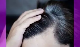 ¿Se empiezan a notar tus canas y no quieres teñirte? conoce el remedio casero para eliminarlas