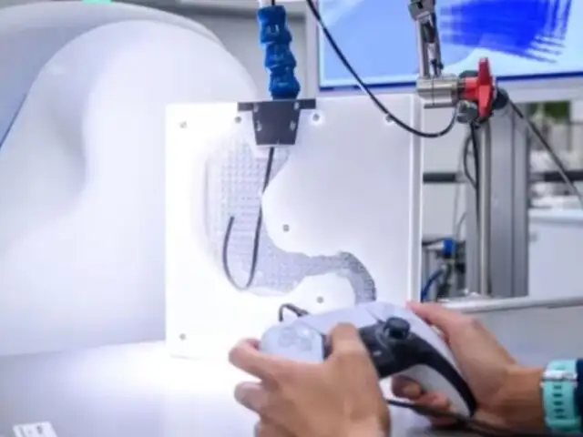 ¡Increíble! realizan endoscopía a distancia con joystick de PlayStation