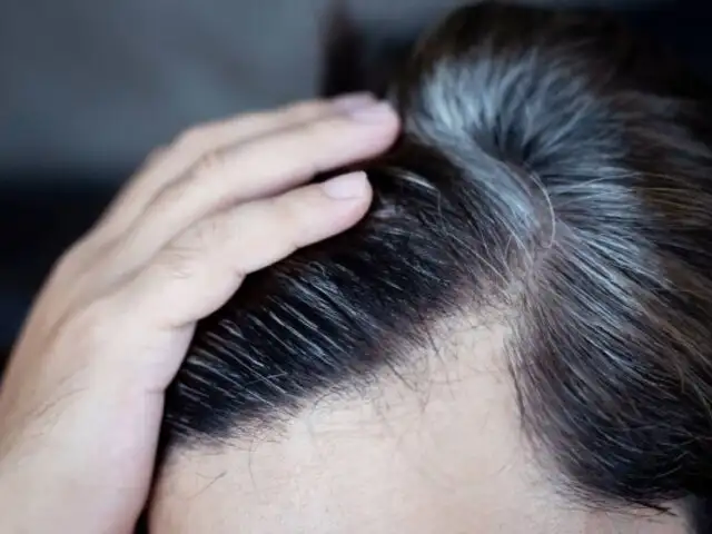 ¿Se empiezan a notar tus canas y no quieres teñirte? conoce el remedio casero para eliminarlas