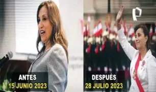 Dina Boluarte: revelan nuevos detalles del presunto procedimiento estético de la presidenta