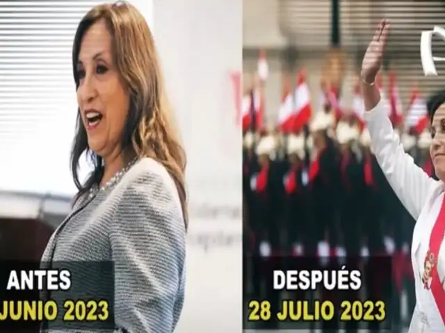 Dina Boluarte: revelan nuevos detalles del procedimiento estético de la presidenta