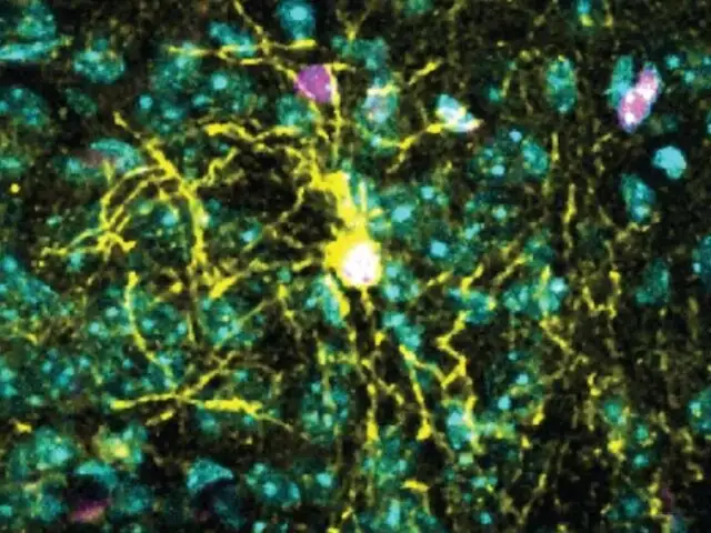 ¿El estrés afecta igual a hombres y mujeres? Descubren importantes diferencias en el cerebro