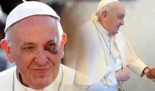 El papa Francisco sufre accidente en el Vaticano: Se cae y se lesiona el brazo derecho