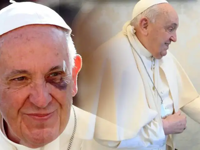 El papa Francisco sufre accidente en el Vaticano: Se cae y se lesiona el brazo derecho