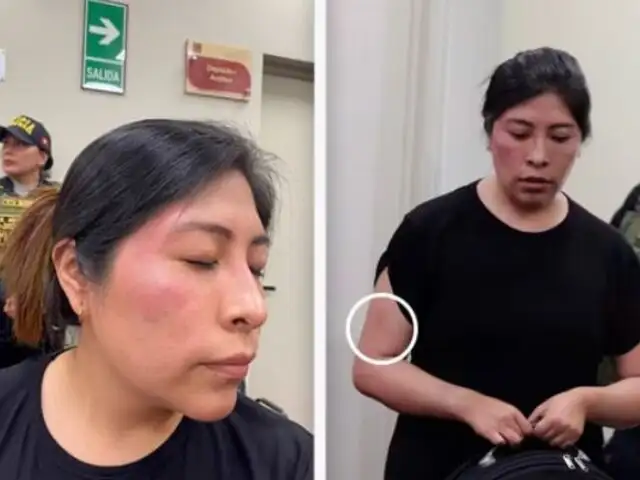 Betssy Chávez apareció en juicio oral con lesiones en el rostro, brazo y pierna