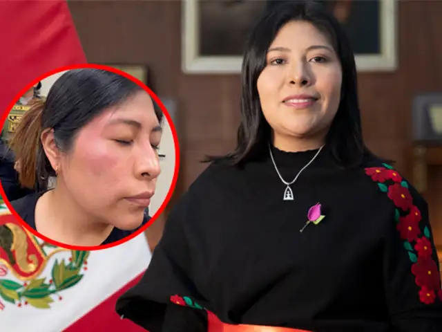 Betssy Chávez denuncia maltratos en su traslado: "Estoy con hematomas y policontusiones"